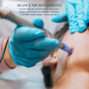 Microneedling 1 séance visage complet